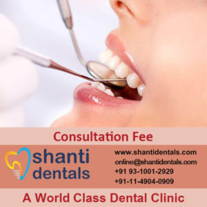 Consultation Fee for Dental Treatment in Rohini by shanti dentals