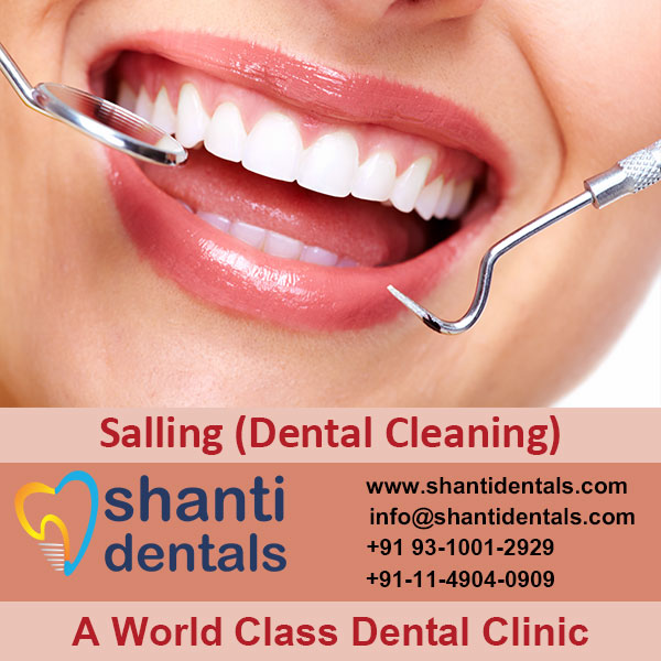 High Quality Salling (Dental Cleaning) Services in Rohini, Delhi