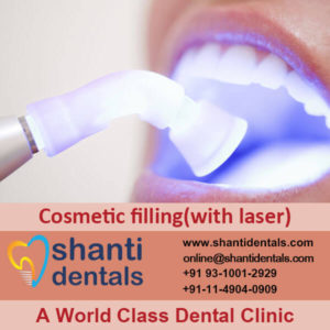 Dental Cosmetic Filling with Laser