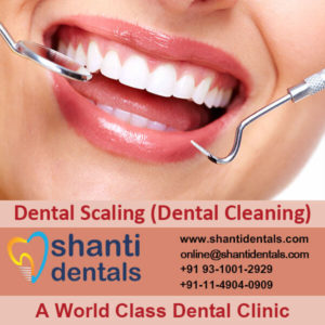 Dental Scaling (Dental Cleaning)