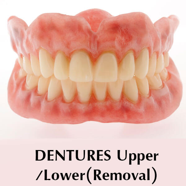 Dentures Upper/Lower (Removal)