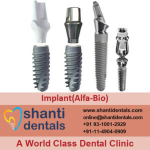 Dental Implant (Alfa-Bio)