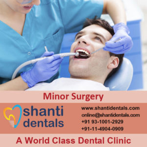 Dental Minor Surgery