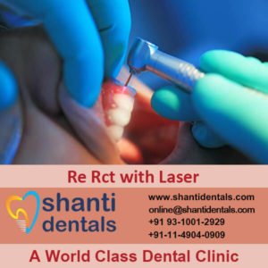 Re Root Canal Treatment with Laser