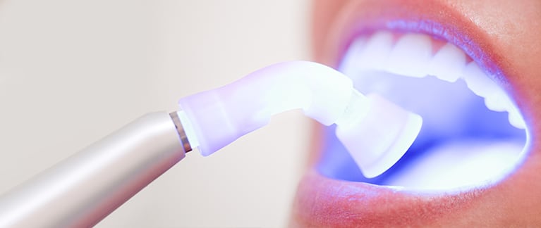 treatment dental implant