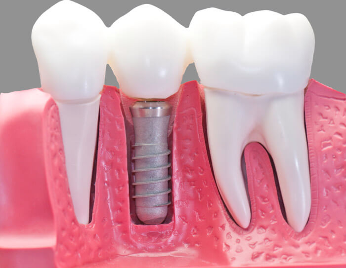 Prosthodontist in Delhi