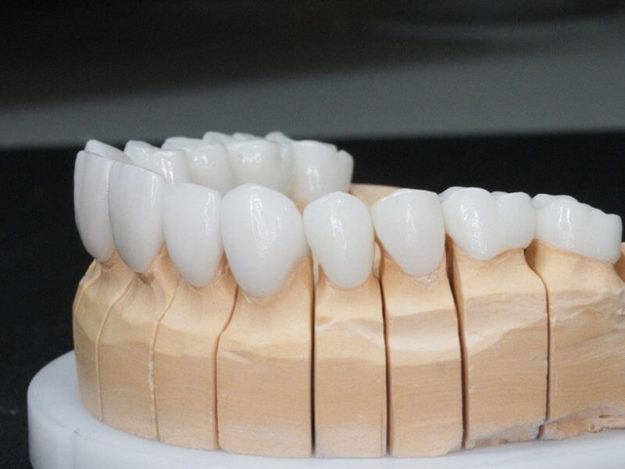 Full Mouth Rehabilitation Full Mouth Rehabilitation