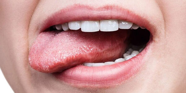 Know Your Mouth: Understanding Oral Cancer Signs & Prevention