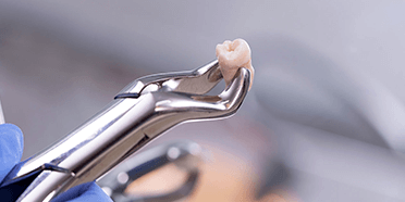 Process of Extracting a Tooth