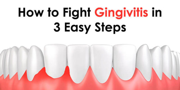 How to Fight Gingivitis in 3 Easy Steps