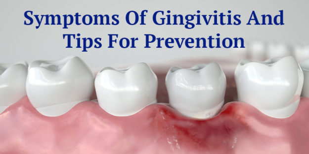 Symptoms of Gingivitis and Tips for Prevention