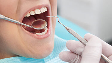 Dental Filling Treatment