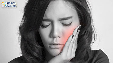 Root Canal Treatment