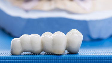 Crowns and Bridges Services in Rohini, Delhi