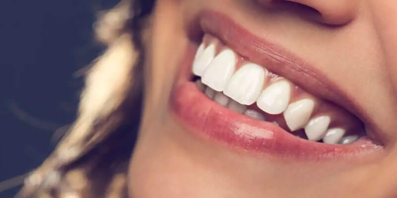 Tips to shine your teeth this Diwali