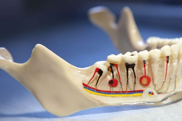 Are Root Canal Treatments Painful?