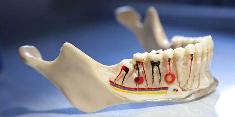 Are Root Canal Treatments Painful?