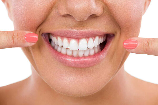 Everything about teeth whitening