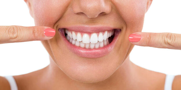 Everything about teeth whitening