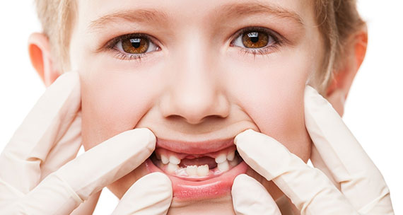 Why Do Cavities Need Treatment
