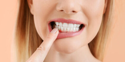 gum-disease-treatment