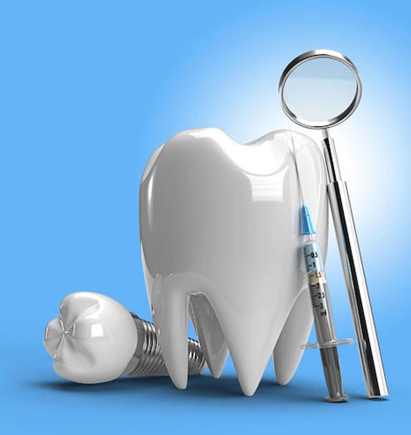 All-on-6 Dental Implant Procedure
