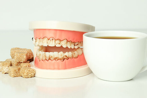 Know About Gum Diseases Treatment