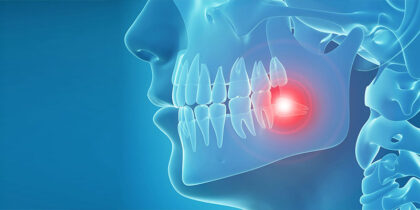 Wisdom Teeth Treatment Wisdom Teeth Treatment