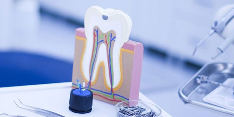 Painless Root Canal Treatment Single Sitting RCT