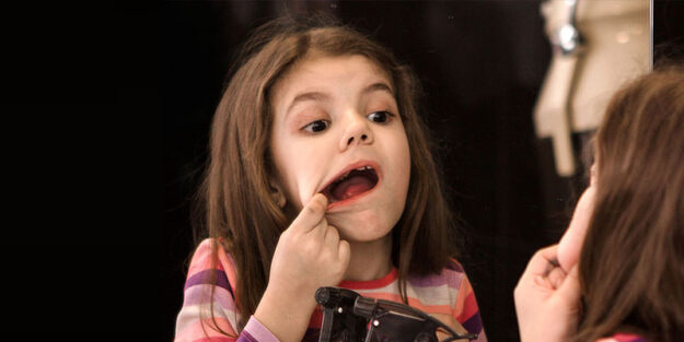 baby-mouth-ulcers-treatment-in-delhi